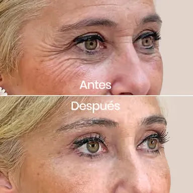 Doha™ | Crema Time Reverse (Todo en uno) | Con Centella Asiática